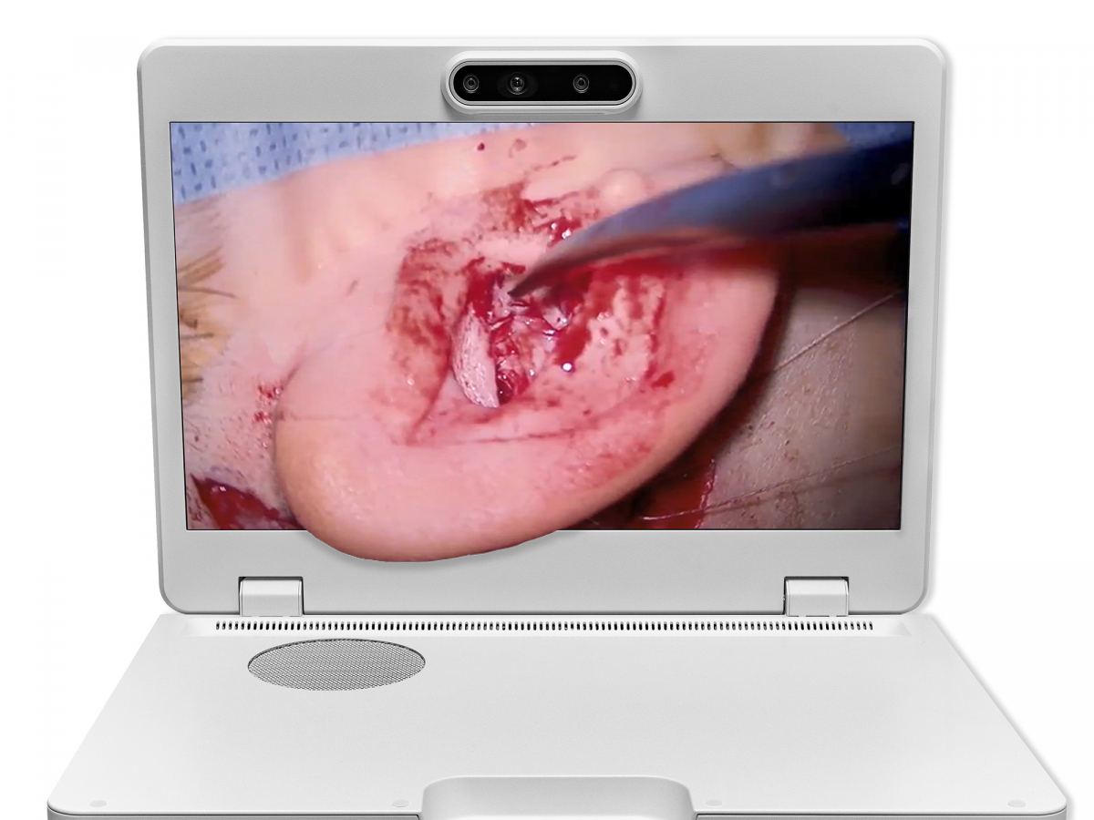 达擎之＂Heads-up 3D显微手术显示系统＂，整合4K裸眼3D显示及眼球追踪系统，具备快速追踪人眼移动位置功能，减轻医师长时间维持固定姿势的负担，让医师能有更宽广清晰的3D立体视野及更舒适的姿势来执行手术。